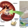 The Kidneys and Baking Soda